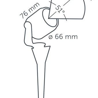 Big Scope 12V Lichtbereik 6m